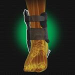 Glezniera Active Ankle Eclipse 1